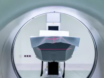 Šta je i čemu služi magnetna rezonanca (MRI)?