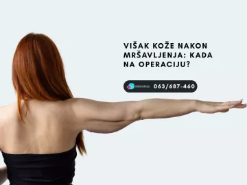 Višak kože nakon mršavljenja: kada na operaciju?