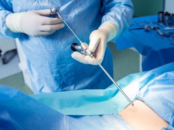 Endoskopska operacija kičme (kod diskus hernije)