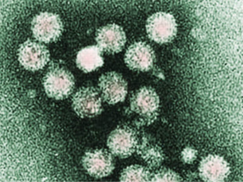 Virus hepatitisa C Hepatitis C je virus. Ovo je slika virusa na mikroskopskom preseku.