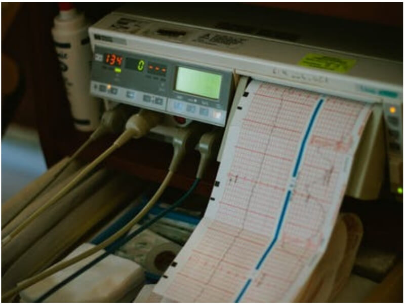 Neimann-Pickova bolest Neimann-Pick-ova bolest odnosi se na grupu naslednih metaboličkih poremećaja poznatih kao leukodistrofije ili poremećaji razgradnje lipida. Kod takvih bolesti dolazi do nakupljanja štetnih količina masti u organima poput slezine, jetre, pluća, koštane srži i mozga.