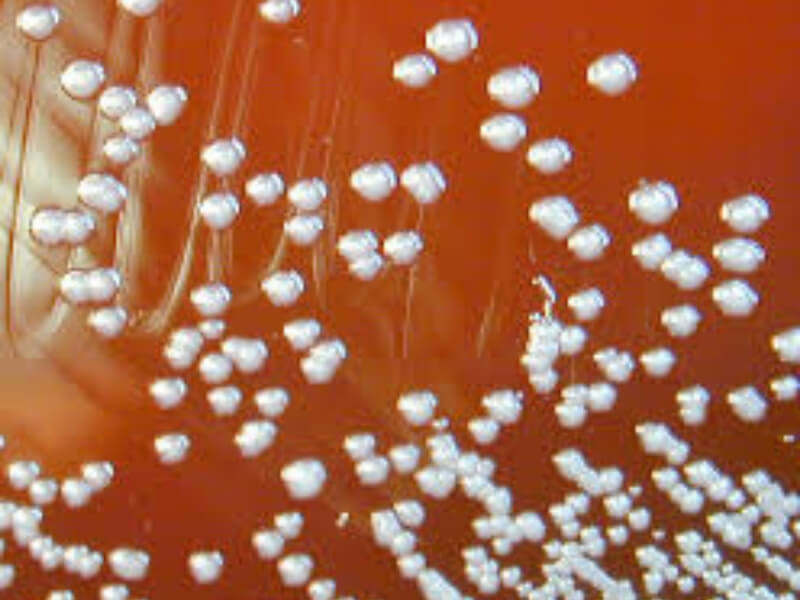 Burkholderia pseudomallei Burkholderia pseudomallei (Malleomyces pseudomallei, Actinobacillus pseudomallei) je štapićasta, Gram negativna, pokretna bakterija, prisutna na tlu i u vodama u tropskim predelima.