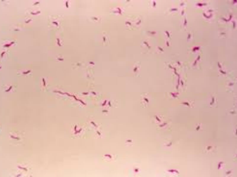 Campylobacter Campylobacter je veoma sitan, u obliku zapete izrazito pokretan i Gram negativan bacil. Bakterija prianja uz zid creva, razara ga i proizvodi toksin koji izaziva bolest. Izvor zaraze za čoveka su domaće životinje (ovce, koze, krave, psi i dr.).