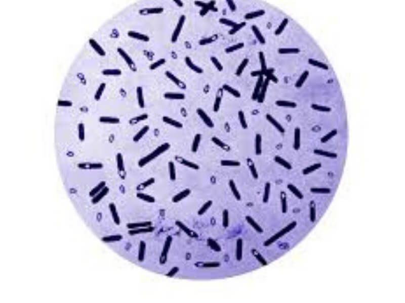 Clostridium botulinum Clostridium botulinum je Gram pozitivna, anaerobna bakterija čije se spore nalaze u zemlji i vodi.