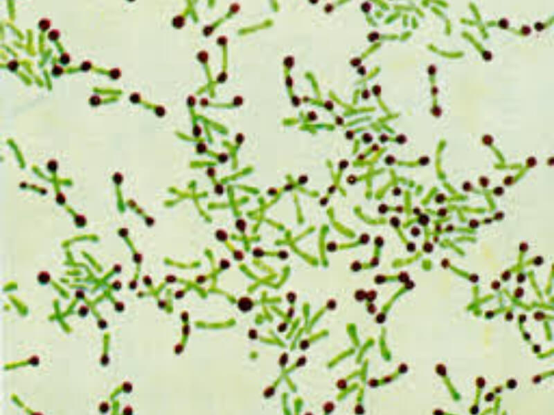Corynebacterium diphtheriae
