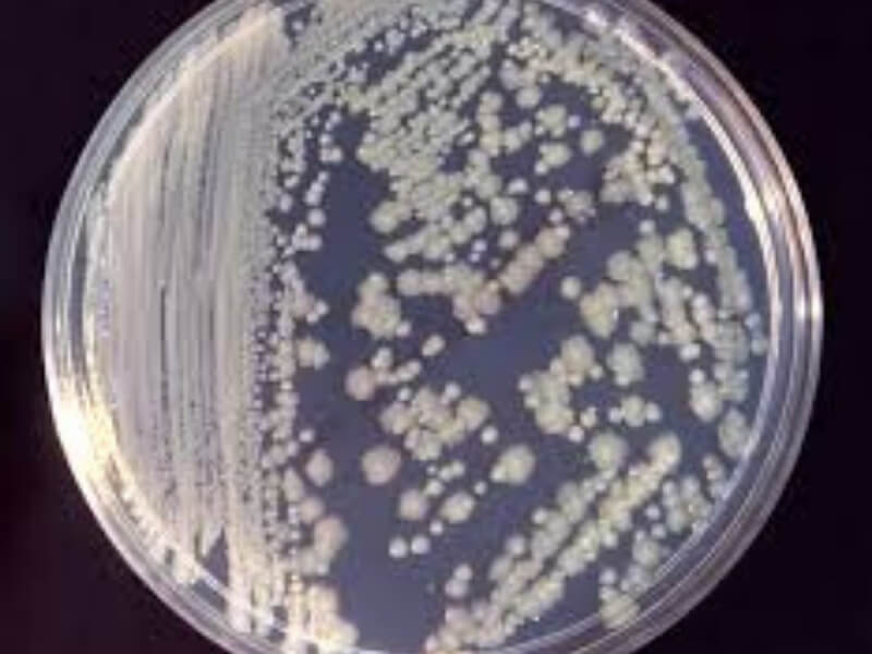 Enterobacter Sve vrste Enterobactera su Gram negativni bacili koji su nepravilno raspoređeni u vidnom polju mikroskopskog preparata. Imaju flagele, kapsulu sintetiše samo jedan deo sojeva Enterobactera.