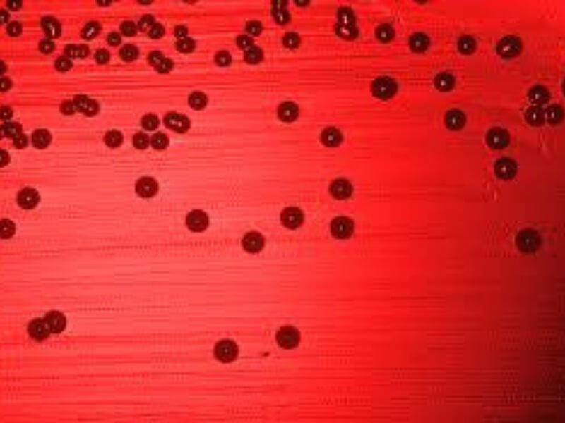Haemophilus influenzae Rod Haemophilus čine mali, nepokretni, asporogeni Gram negativni bacili, za čije kultivisanje je neophodna krv u podlozi sa faktorima X i V. Haemophilus influenzae ima spoljašnju membranu i produkuje endotoksin. Na osnovu građe polisaharida oblici sa kapsulom su podeljeni na 6 serotipova.