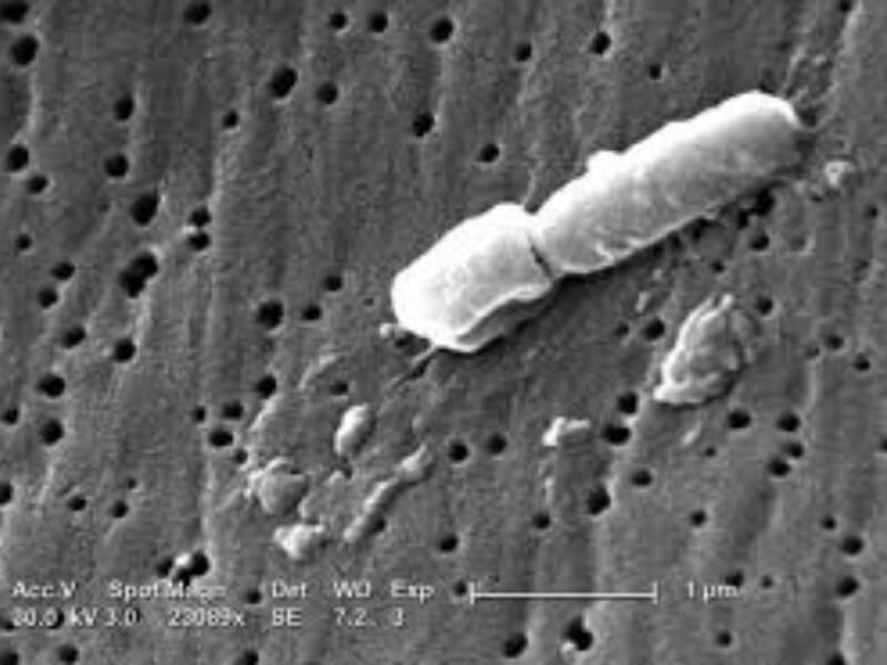 Klebsiella pneumoniae ss. pneumoniae Sve Klebsiellae su Gram negativni bacili sa zaobljenim krajevima. Raspoređuju se pojedinačno ili u vidu parova. Nemaju flagele i nepokretne su. Fimbrije sa adherentnim svojstvima i kapsula predstavljaju značajne faktore virulencije.