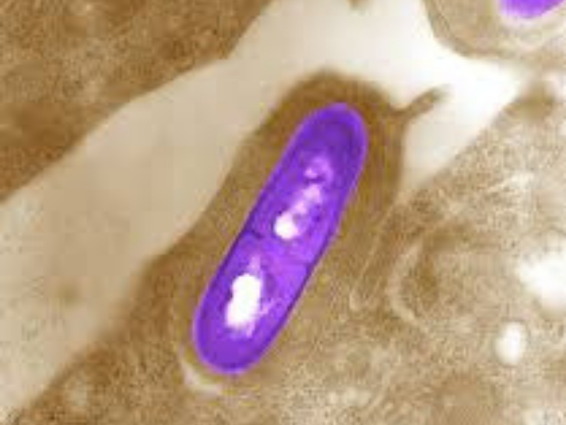 Listeria monocytogenes Značajna karakteristika L. monocytogenes jeste da raste i na temperaturi od 4 °C, što znači da čuvanje hrane u frižideru nema značajno dejstvo na sprečavanju rasta ove bakterije.