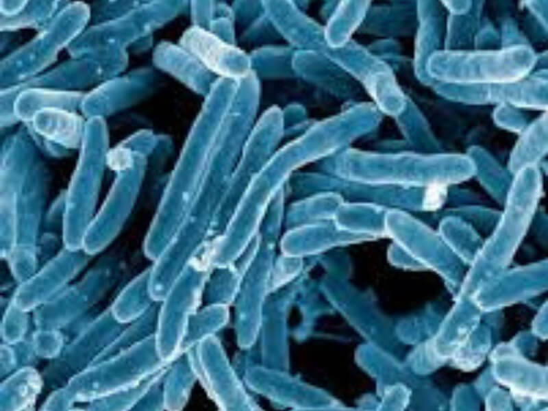 Mycobacterium tuberculosis Mikobakterije su pravi ili lako savijeni vitki bacili, teško se boje po Gramu (Gram pozitivni bacili), ali se lako boje karbol fuksinom tehnikom po Ziehl - Neelsenu i tada se ne mogu odbojiti alkoholom i kiselinom. Mikobakterije su intracelularni paraziti koji izazivaju hronična oboljenja sa formiranjem granulomatoznih lezija.
