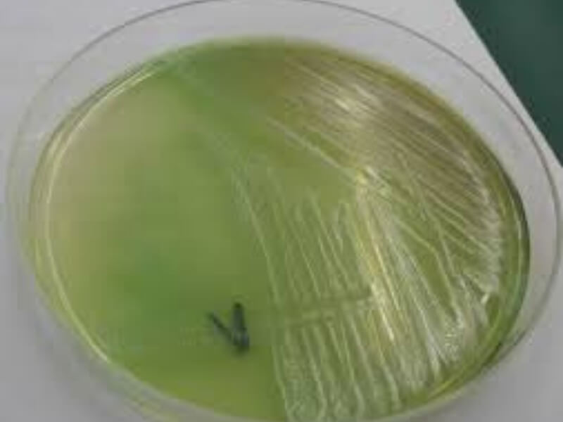 Pseudomonas aeruginosa Pseudomonas aeruginosa (bacillus pyocyaneus) je u spoljnoj sredini široko rasprostranjena i izrazito otporna bakterija. To je Gram negativan, asporogen bacil. Brzo se kreće pomoću monopolarno raspoređenih flagela. Većina sojeva ima fimbrije. Striktni je aerob. P. aeruginosa ima brojne faktore virulencije, uključujući celularne komponente, toksine i enzime.