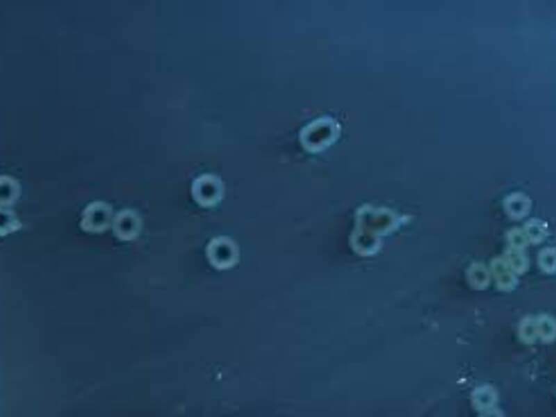 Salmonella paratyphi Salmonellae su Gram negativni bacili iz familije Enterobacteriaceae, asporogene su, osetljive na hemijske i fizičke agense. Postoje tri vrste Salmonellae paratyphi – A, B i C. Nemaju kapsulu, kao ni sposobnost formiranja spora. Nisu probirači, rastu dobro na svim hranljivim podlogama, a prema potrebama za kiseonikom svrastavaju se u aerobe i fakultativne anaerobe.