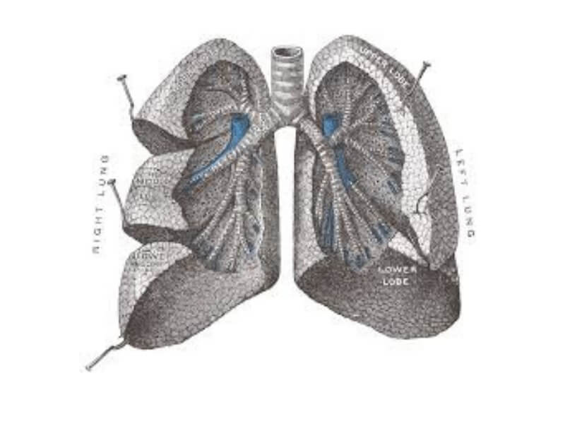 Akutni respiratorni distres sindrom odraslih Akutni respiratorni distres sindrom (ARDS) odraslih osoba klinički je sindrom akutne respiratorne insuficijencije, odnosno akutnog plućnog edema. Nastaje usled oštećenja parenhima pluća i manifestuje se bilateralnom plućnim infiltratima, teškom i refrakternom hipoksemijom i teškom dispnejom, zbog redukcije plućne komplijanse.