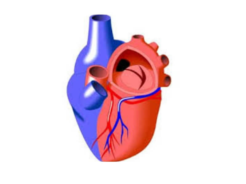 Insuficijencija zaliska plućne arterije Insuficijencija zaliska plućne arterije omogućava vraćanje krvi iz plućne arterije u desnu komoru tokom dijastole.