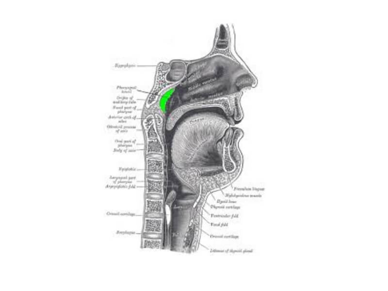 Adenoiditis acuta