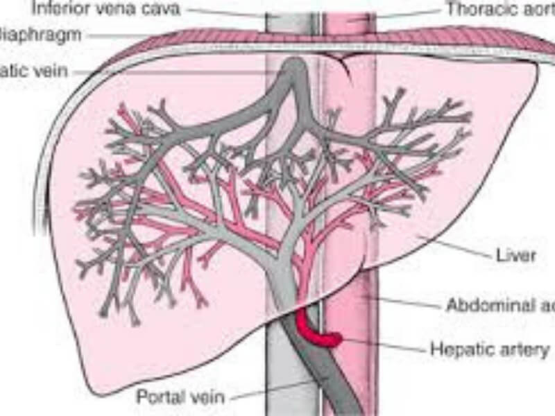 Oboljenja krvnih sudova jetre Tromboza hepatičke arterije može nastati u toku tumoroznih procesa, citostatske terapije, infekcije, endokarditisa, ligatura u toku operacija, trombocitopenične purpure, poliartritisa, generalizovane arterioskleroze i dr.