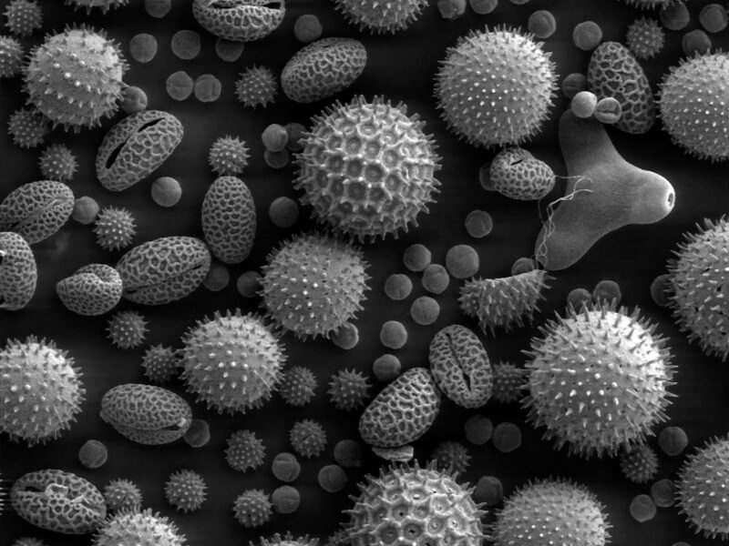 Hipertrofični rinitis Hipertrofični rinitis (rhinitis chronica hypertrophica) predstavlja uznapredovali stadijum kod hroničnog rinitisa sa stalnom hipertrofijom sluzokože.