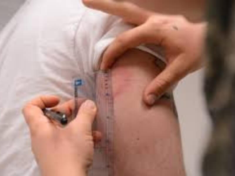 Otkriven protein ključan za alergijsku reakciju Stručnjaci japanskog Istraživačkog centra za alergiju i imunologiju (RIKEN) možda su otkrili put za sprečavanje alergijskih reakcija, pošto su identifikovali molekul STIM1, u čijem odsustvu organizam više nije podložan alergijama.