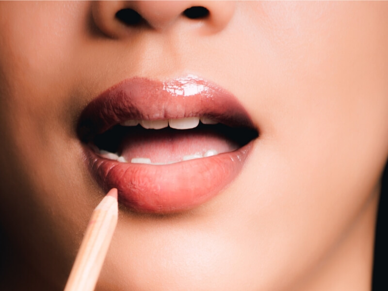 Povećanje usana: Biopolimer ili hijaluron Šta odabrati? Hijaluron ili biopolimer?