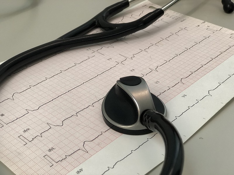 Elektrokardiogram (EKG) Elektrokardiogram predstavlja grafički prikaz električne aktivnosti miokarda, koja nastaje kao rezultat električnih zbivanja na membranama miokardnih ćelija.