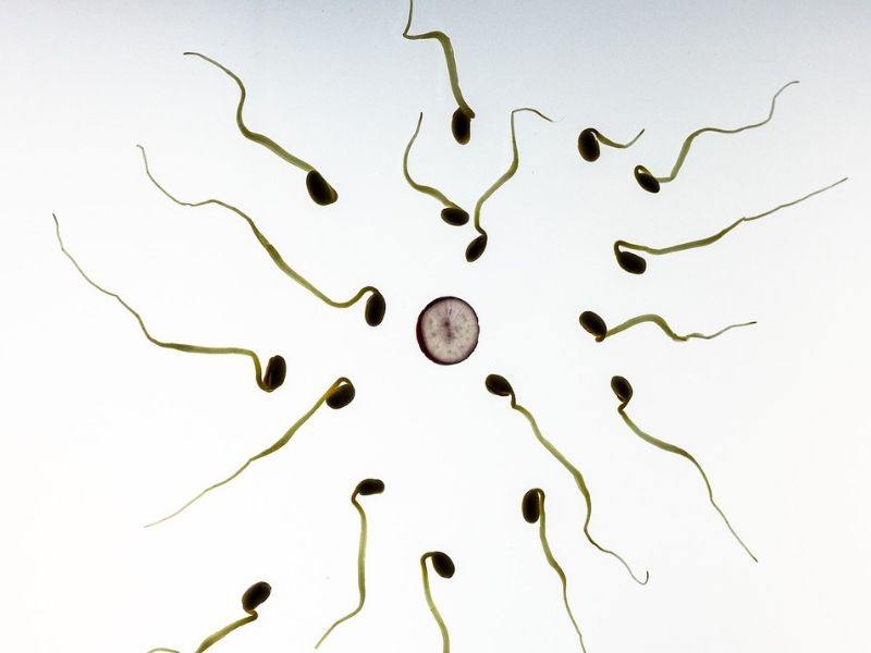 Spermogram - kako se radi i šta otkriva
