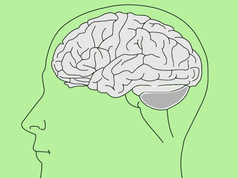 Epilepsija