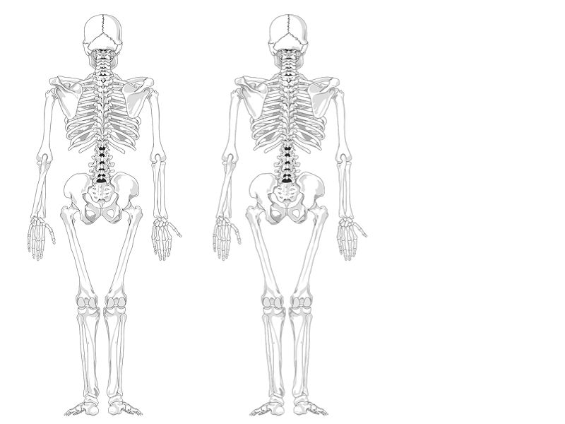 DEXA, DXA dijagnostika