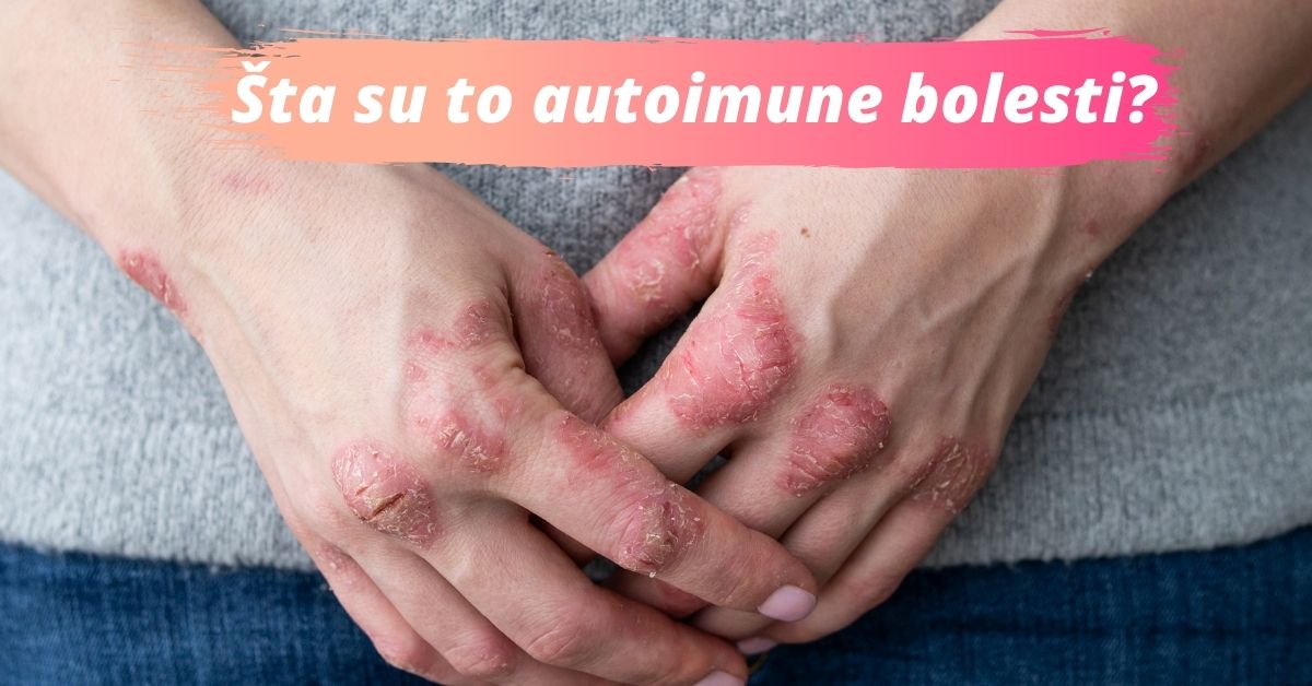 Reumatoidni artritis: Uzrok, simptomi i kako se liječi ova autoimuna bolest?