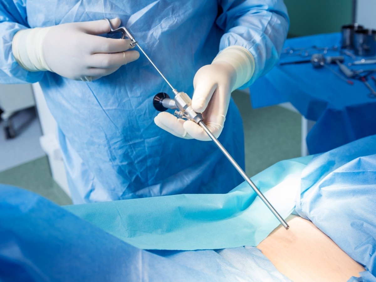 Endoskopska operacija kičme (kod diskus hernije)