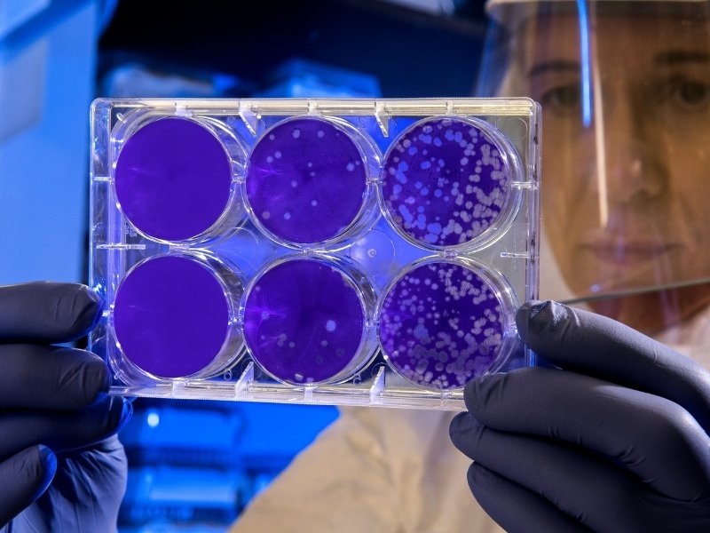 Kako smo stvorili superbakterije i šta ćemo sad?