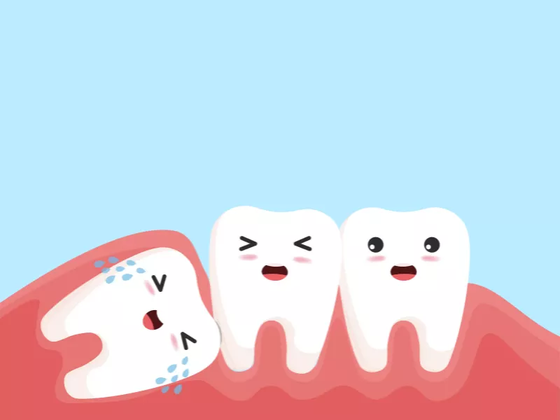 Zašto su umnjaci toliko problematični zubi?