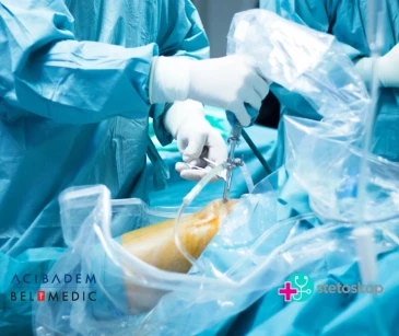 Artroplastika kolena thumbnail