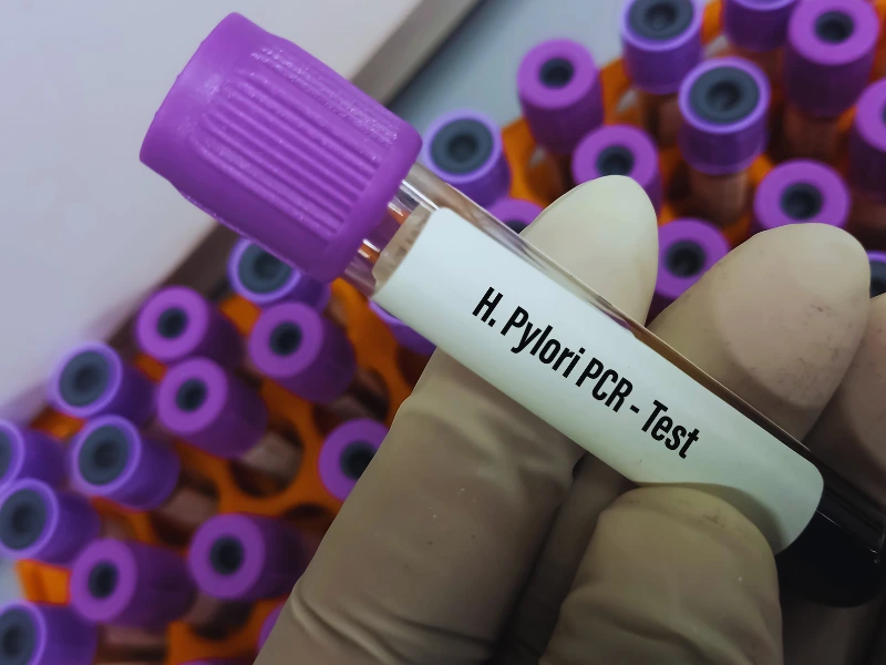 Kako se prenosi Helicobacter pylori?