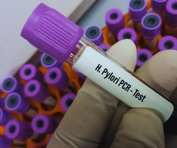 Kako se prenosi Helicobacter pylori? thumbnail