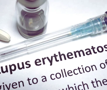 Sistemske bolesti vezivnog tkiva - eritremski lupus thumbnail