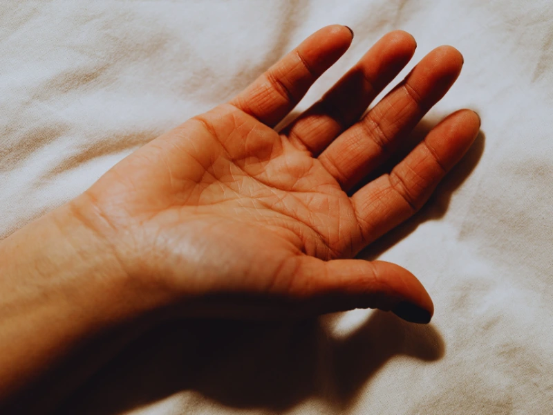 Dupuytrenova kontraktura – zašto je hirurgija šake jedino trajno rešenje?