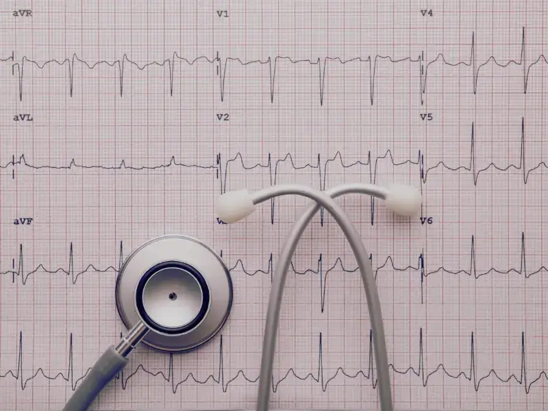 Šta je EKG i šta pokazuje?