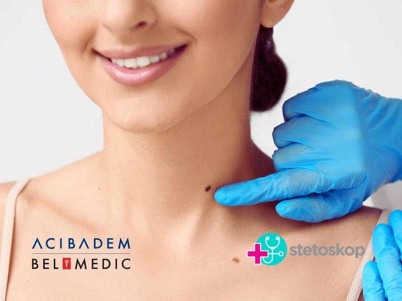 Pregled mladeža: kada je vreme da odete kod dermatologa?