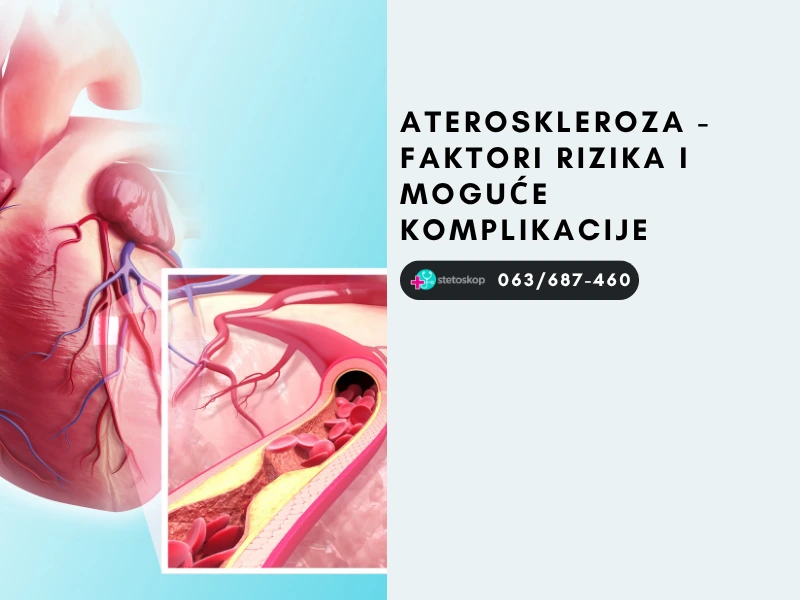 Ateroskleroza - faktori rizika i moguće komplikacije