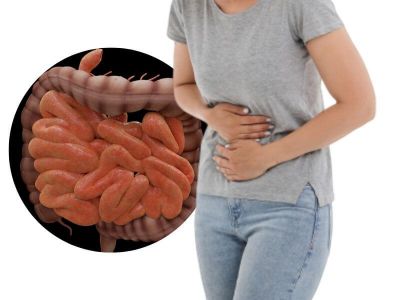 Ulcerozni kolitis je nespecifično zapaljenjsko oboljenje alimentarnog trakta. Ovaj zapaljenski proces zahvata strukture kolona (debelo crevo). Ulcerozni kolitis je izuzetno sličan Crohnovoj bolesti.