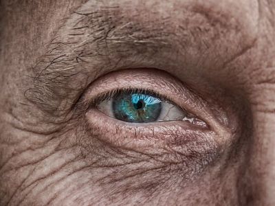 Kod bolesnog oka, krvni sudovi su izuzetno loši i efekat se nikada ne može znati unapred. U lečenju hroničnih komplikacija na oku se koriste VEGF, virektomija, laser