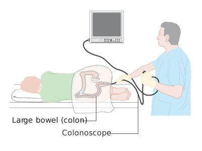 Kolonoskopija je optičko ispitivanje debelog creva kolonoskopom. Kolonoskop je fleksibilna cev sa izvorom svetla i delom za posmatranje. On omogućava doktoru da vidi unutrašnjost debelog creva sićušnom videokamerom.