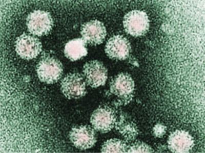 Hepatitis C je virus. Ovo je slika virusa na mikroskopskom preseku.