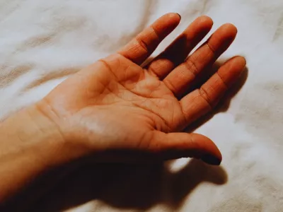 Dupuytrenova kontraktura je bolest šake u kojoj se vezivno tkivo ispod kože dlana (tzv. palmarna aponeuroza) postepeno zadebljava i skraćuje. Zbog toga se u dlanu mogu napipati čvorići i/ili zategnute “vrpce”, a jedan ili više prstiju počinje da se savija ka dlanu i vremenom se sve teže ispravlja.