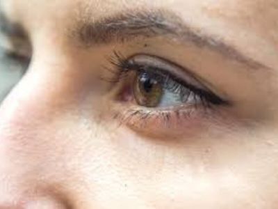 Entropium je uvrtanje ruba kapka prema očnoj jabučici, tako nastaje trichiasa - trepavice dođu u dodir sa površinom rožnjače (corneae) i vežnjače (conjunctive). Dolazi do osećaja stranog tela u oku, grebanja i suzenja.