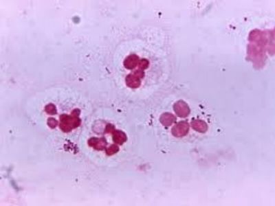 Uretritis non specifica (uretritis simplex, uretritis non gonoroica) podrazumeva svako zapaljenje uretre koje nije izazvano Neisseri-om gonorrhoeae. S obzirom da se infekcija najčešće nastaje pri polnom odnosu, Svetska zdravstvena organizacija je NGU uvrstila u bolesti koje se prenose seksualnim kontaktom.