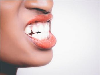 Gingivalni osmeh - rekonstrukcija usne