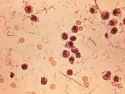 Šigele (shigellae) su striktno patogene crevne bakterije. To su Gram negativni, tanki, pravi štapići. Nepokretni su i ne stvaraju sporu i poseduju fimbrije.