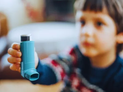 Bronhijalna astma kod dece Astma je hronična inflamatorna bolest pluća koju karakteriše povremena opstrukcija disajnih puteva-bronhija, uzrokujući otežano disanje.