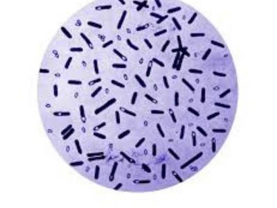 Clostridium botulinum je Gram pozitivna, anaerobna bakterija čije se spore nalaze u zemlji i vodi.